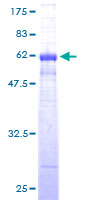 12.5% SDS-PAGE Stained with Coomassie Blue.